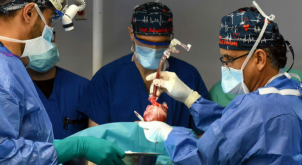 College of Maryland plays 2d pig coronary heart transplant