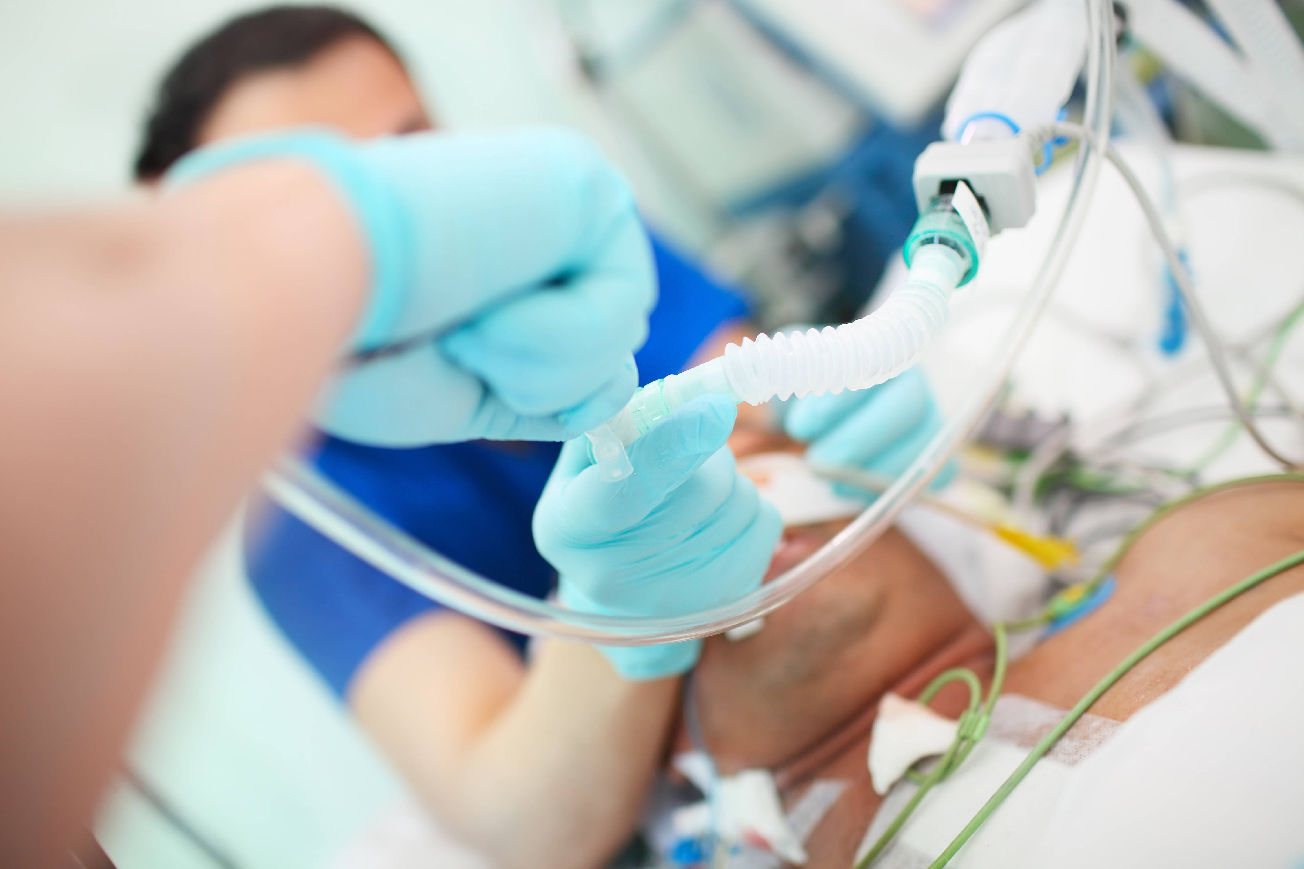 Hospital staff intubate a patient infected with the coronavirus