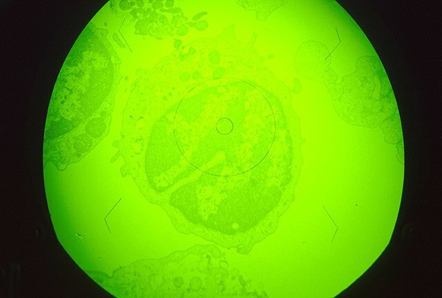 Newly recognized key gene is significant for African swine fever an infection