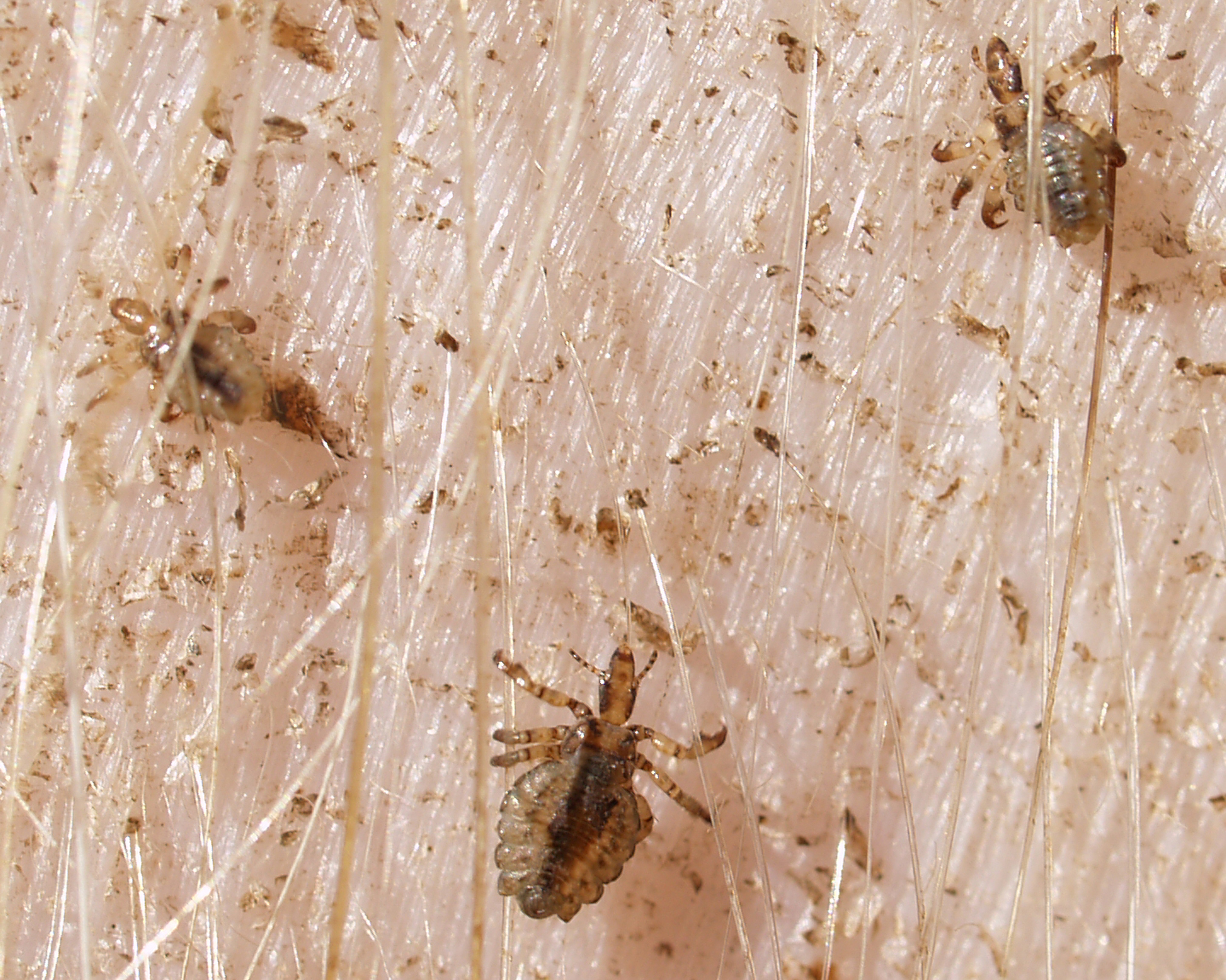 Hog lice (Haematopinus suis)