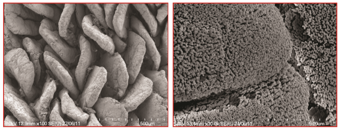 Electron micrograph of villi (left) and microvilli (right) of the small intestine.