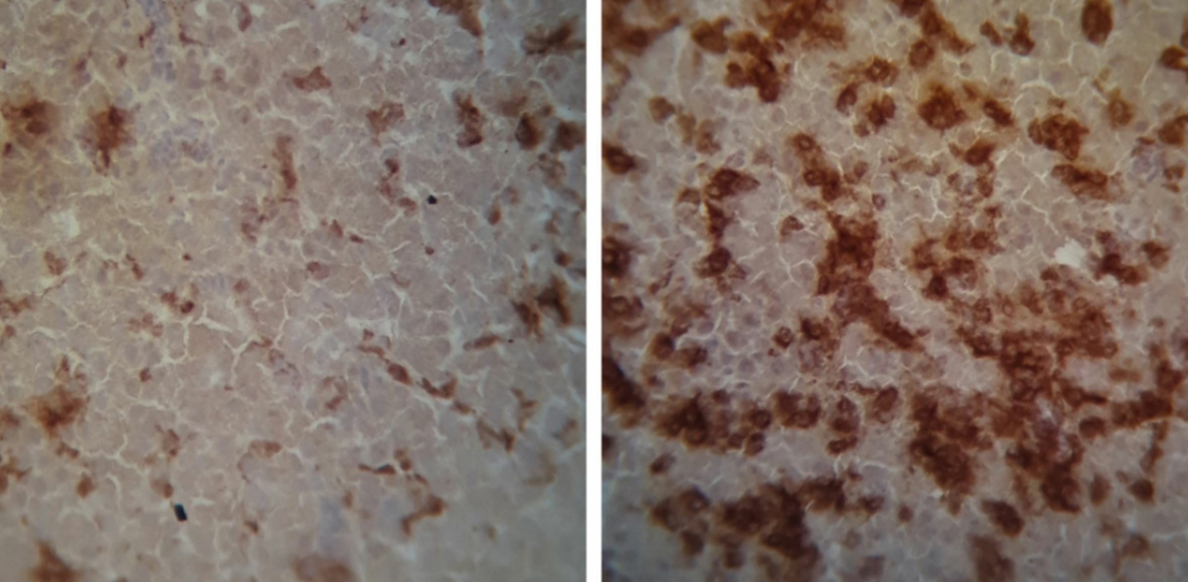 Mutant Salmonella traces make an infection extra competitive in industrial poultry