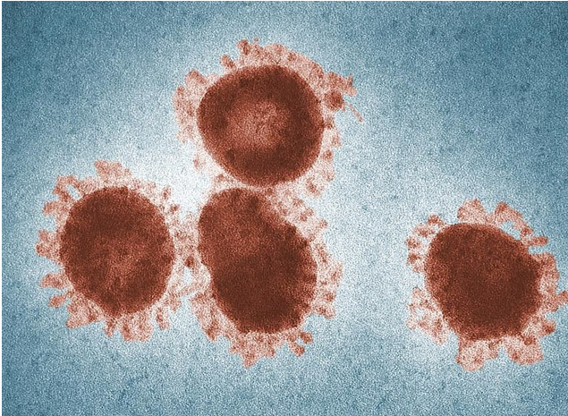 Avian Coronavirus (Public Health Image Library from the Centres for Disease Control and Prevention CDC, Unsplash)
