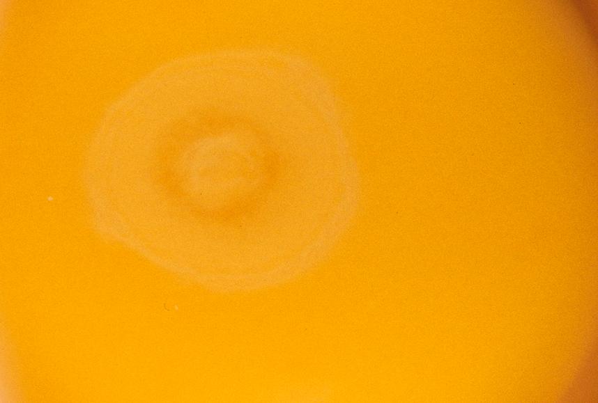 a yellow yolk with embryo visible