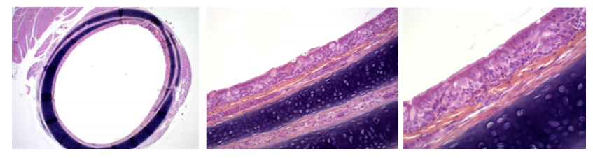 Score 0 = No inflammatory lesion. Rare Lymphocytes and Plasmocytes. No congestion.