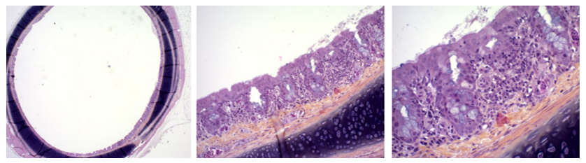 Score 2 = Moderate inflammatory lesions. Lymphocytes and plasmocytes invasion inducing thickening spots around the trachea wall.