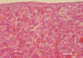 Fig. 1. Congestion (overfilling of blood vessels with red blood cells) of the liver as an initial manifestation of E. coli septicaemia in a broiler chicken. H/E, Bar = 40 µm.