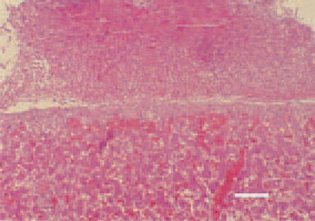 Fig. 3. Serofibrinous perihepatitis. Organization of pseudomembranous deposits. H/E, Bar = 50 µm.