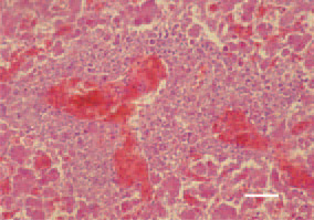 Fig. 4. Е. coli septicaemia. Massive perivascular liver necrosis. H/E, Bar = 30 µm.