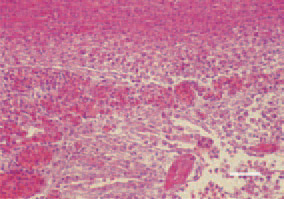 Fig. 6. Croupous pleuropneumonia - one of the commonest findings in Е. coli septicaemia of respiratory origin. H/E, Bar = 25 µm.