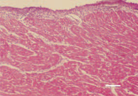 Fig. 7. Serofibrinous pericarditis and inflammatory oedema of the myocardium in Е. coli septicaemia. H/E, Bar = 30 µm.