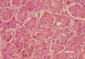 Fig. 8. Degenerative necrobiotic lesions in the epithelium of renal tubules. H/E, Bar = 25 µm.