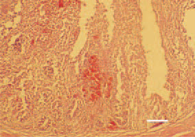 Fig. 9. Catarrhal haemorrhagic enteritis caused by an enterotoxigenic Е. coli strain. H/E, Bar = 100 µm.