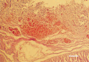Fig. 11. Haemorrhages in the proventriculus mucous coat in colisepticaemia of enteric origin, secondary to necrotic enteritis. H/E, Bar = 100 µm.