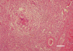Fig 15. Coligranuloma (Hjarre’s disease). Coligranuloma, liver. H/E, Bar = 35 µm.