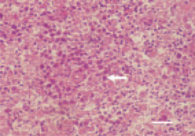 Fig. 1. Pullorum disease. Perivascular
proliferative inflammatory focus in
the liver, consisting mainly of histiocytes
and single epitheloid cells (arrow).
H/E, Bar = 25 µm.