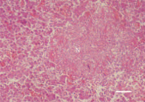 Fig. 2. Fowl typhoid. Areactive fibrinoid
necrosis (N) in the liver. H/E, Bar
= 40 µm.