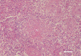 Fig. 3. Fowl typhoid. Periarteriolar
fibrinoid necrosis (N) in the spleen.
Marked cell reaction in the periphery
of the necrotic foci involving lymphocytes,
histiocytes and single granulocytes.
H/E, Bar = 50 µm.