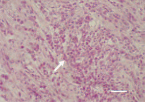 Fig. 4. Fowl typhoid, hen. Mononuclear
inflammatory cell proliferate in
the myocardium (arrow). H/E, Bar =
30 µm.
