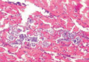Fig. 2. Interstitial and parenchymatous
myocarditis in a broiler
chicken. Bacterial colonization
and bacterial thrombi in the myocardium
(arrows) in staphylococcal
septicaemia. H/E, Bar = 25 µm.