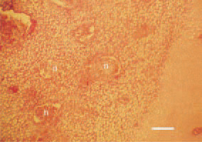 Fig. 7. Staphylococcal osteomyelitis.
Focal inflammatory necrotic lesions in
the growth plate of the proximal femur
in a broiler chicken. H/E, Bar = 40 µm.