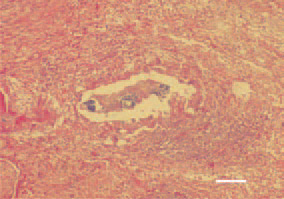Fig. 9. Staphylococcal tenosynovitis.
Central caseous necrotic lesions
and clusters of bacterial colonies.
Intensive inflammatory cell reaction
(lymphocytes, granulocytes and
macrophages) affecting the tendon
sheath layers. H/E, Bar = 40 µm.