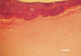 Fig. 10. Staphylococcal arthritis. Degenerative
necrobiotic lesions and
massive bacterial colonization (St) of
the distal femoral articular cartilage
in a growing male broiler breeder.
H/E, Bar = 40 µm.