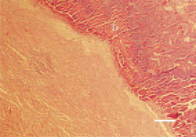 Fig. 1. Valve thromboendocarditis.
Massive thrombotic masses (Tr) coating
the mitral valve in the left heart
side of a duck. It is generally associated
with Streptococcus zooepidemicus.
H/E, Bar = 40 µm.