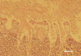 Fig. 2. Croupous pleuropneumonia.
Fibrinous pseudomembrane, coating
the pleural surface. Cell-rich inflammatory
infiltrate among the fibrinous
coating and the lung parenchyma.
H/E, Bar = 40 µm.
