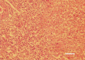 Fig. 3. Airsacculitis, a transverse crosssection
of the air sac, broiler chicken.
Mixed inflammatory cell exudate and
fibrinous caseous masses. H/E, Bar =
35 µm.