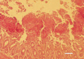 Fig. 1. Necrosis of small intestinal mucous
coat. The affected mucosal layer
is altered into necrotic detritus, part
of which protrudes into the intestinal
lumen. H/E, Bar = 40 µm.