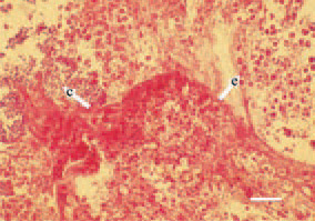 Fig. 2. Simultaneous presence of
Clostridium organisms (arrow - с) and
Eimeria developmental forms (arrow
- е) among the necrotic small intestinal
mucosa in a broiler chicken. H/E,
Bar = 30 µm.
