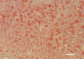 Fig. 5. Necrotic enteritis in a broiler
chicken. Severe liver congestion. H/E,
Bar = 100 µm.