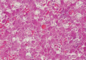 Fig. 6. Necrotic enteritis in a broiler
chicken. Liver, activated macrophages
and enhanced phagocytosis of erythrocytes.
H/E, Bar = 35 µm.