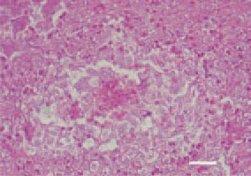 Fig 1. Liver. Multiple outgrown bile
ducts, forming a granuloma structure
with a central necrosis. H/E, Bar = 35
µm.