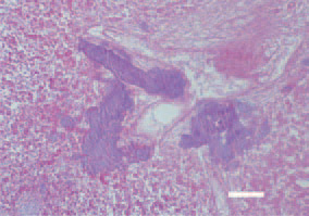 Fig. 2. Liver. A biliary stasis and a huge
amount of Gram-positive organisms in
bile ducts. Gram staining, Bar = 25 µm.