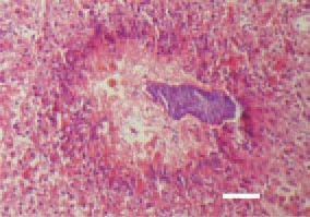 Fig. 3. Liver. Pericanalicular biliary necroses.
H/E, Bar = 50 µm.
