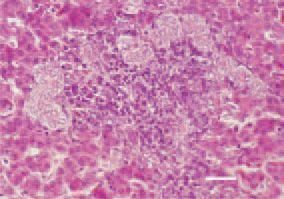 Fig. 5. Hepatosis in the liver of a broiler
chicken. Proliferation of bile ducts
and fibrous tissue, that have infiltrated
the portal zones through mononuclear
cells. H/E, Bar = 25 µm.