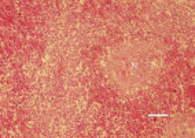 Fig. 1. Liver. Well- or poorly demarcated
coagulative necroses (N) with
minor inflammatory reaction and peripheral
haemorrhagic zone. H/E, Bar
= 40 µm.