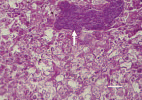 Fig. 2. Liver. The histological section
reveals groups as well as intralesional
UE organisms, spread among the
parenchyma (arrow). H/E, Bar = 25
µm.