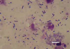 Fig. 3. Touch imprint preparation
of intestinal content from a broiler
chicken with UE. Multiple UE agents
and desquamated epithelial cells
from the necrotic mucous coat. Diff
Quik, Bar = 10 µm.