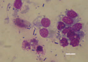 Fig. 4. Touch imprint preparation of
a liver cross section. Typical UE microorganisms,
straight or slightly curved
rods with rounded tips. Diff Quik, Bar
= 10 µm.