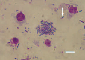 Fig. 5. Element of Fig. 4. A bacterium
with characteristic subterminal spore
(arrow). Diff Quik, Bar = 10 µm.