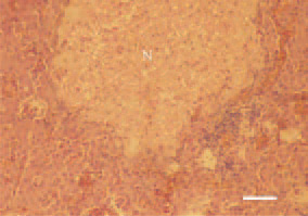 Fig. 1. Liver, hen. Well-demarcated
coagulative necrosis (N) against the
surrounding parenchyma. Marked
peripheral reaction through inflammatory
cell proliferate and hyperaemia.
H/E, Bar = 50 µm.