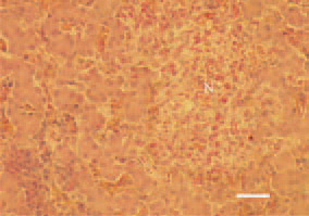 Fig. 2. Reactive necrosis (N), liver,
hen. Multiple eosinophilic granulocytes
among the necrotic focus and
perivascular inflammatory cell clusters.
H/E, Bar = 35 µm.