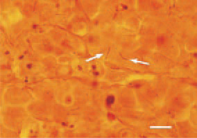 Fig. 3. B. anserina, of a filiform helical
shape, mucronate at the apexes (arrows)
among the hepatic cells. Liver
cross-section, Levaditi staining, Bar =
25 µm.