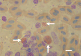 Fig. 1. Touch imprint preparation
from the air sac of a duck. Intracytoplasmic
red chlamydial elemental
bodies. Giemsa stain, Bar = 10 µm.