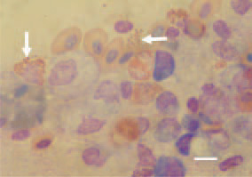Fig. 3. Touch imprint preparation
from the air sac of a duck. Multiple
intracytoplasmic red chlamydial elemental
bodies. Giemsa stain, Bar =
10 µm.