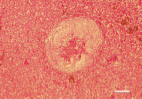 Fig. 1. Tubercle, liver, ostrich. Centrally,
a cluster of epitheloid cells (that
are fusiform in birds), radially directed
to the centre of the granuloma, is
visible. Appearance of foreign bodytype
giant cells and initial capsulation.
H/E, Bar = 50 µm.