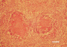 Fig. 4. Symmetrical, caseous necrotic
foci in the intestinal wall in a hen.
Peripherally, foreign body-type giant
cells. H/E, Bar = 40 µm.